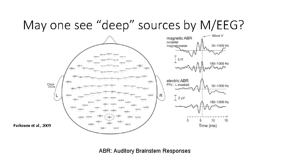 May one see “deep” sources by M/EEG? Parkonen et al. , 2009 ABR: Auditory