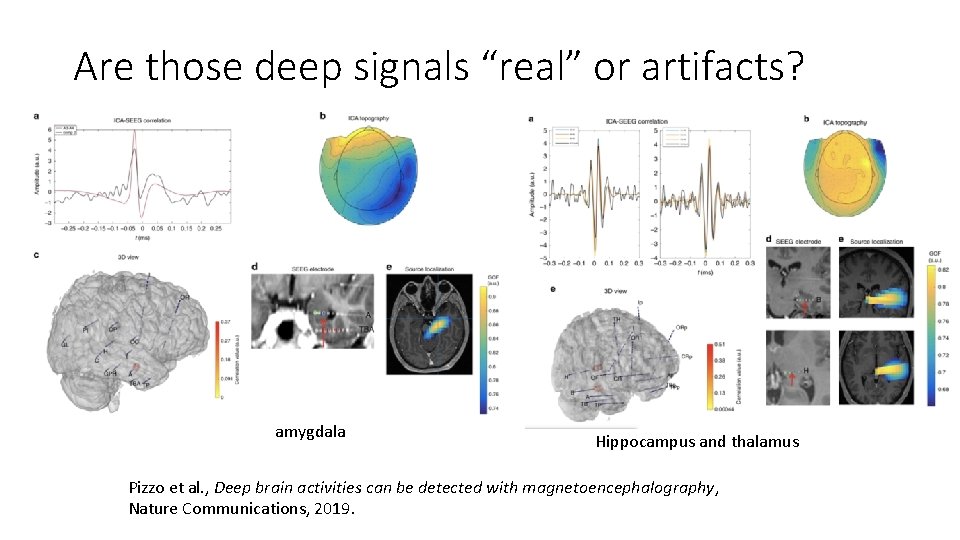 Are those deep signals “real” or artifacts? amygdala Hippocampus and thalamus Pizzo et al.