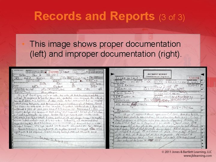 Records and Reports (3 of 3) • This image shows proper documentation (left) and