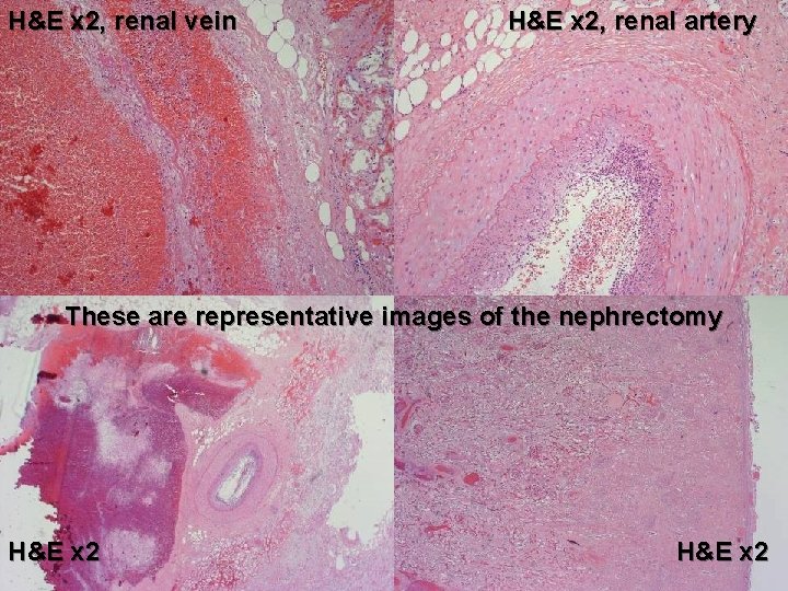 H&E x 2, renal vein H&E x 2, renal artery These are representative images