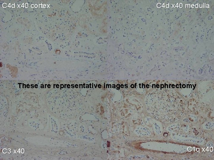 C 4 d x 40 cortex C 4 d x 40 medulla These are