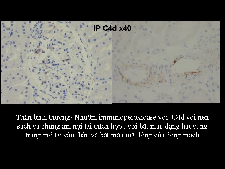 IP C 4 d x 40 Thận bình thường Nhuộm immunoperoxidase với C 4