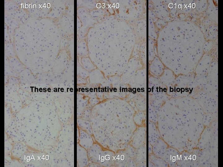 fibrin x 40 C 3 x 40 C 1 q x 40 These are