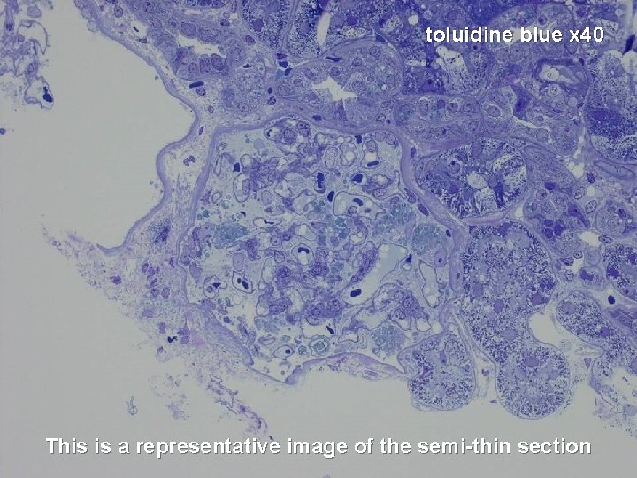 toluidine blue x 40 This is a representative image of the semi-thin section 