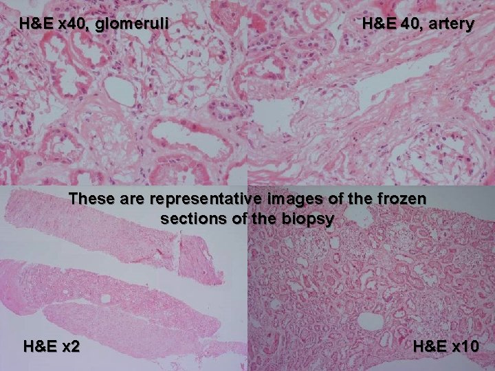 H&E x 40, glomeruli H&E 40, artery These are representative images of the frozen
