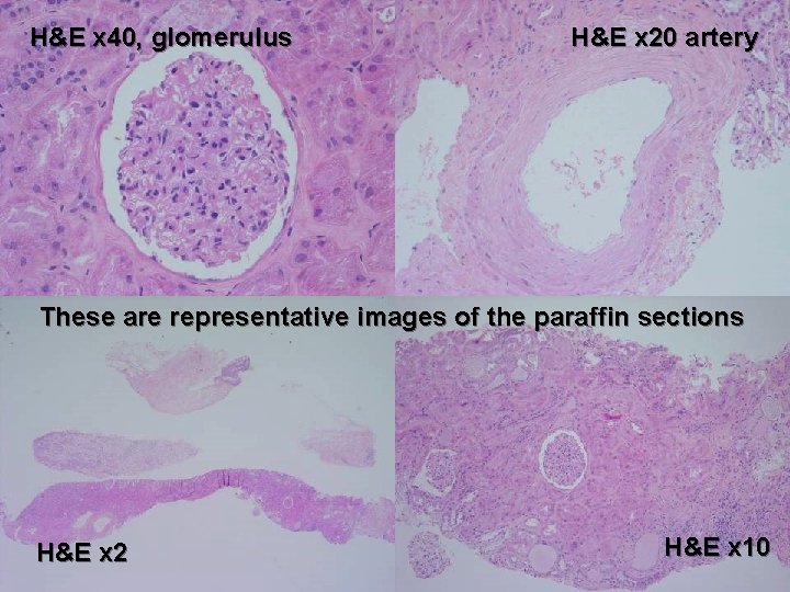 H&E x 40, glomerulus H&E x 20 artery These are representative images of the