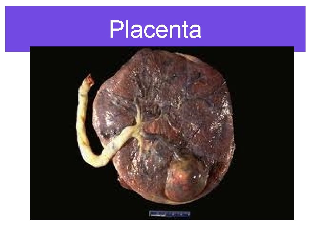 Placenta 