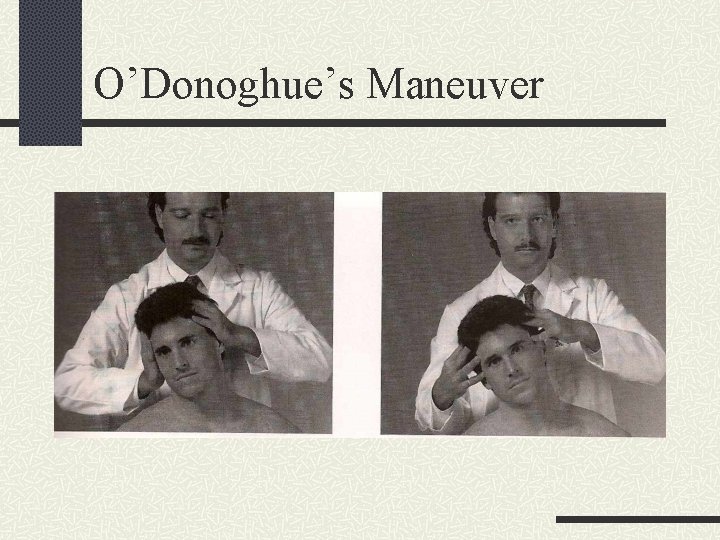 O’Donoghue’s Maneuver 