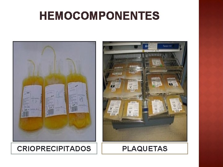 HEMOCOMPONENTES CRIOPRECIPITADOS PLAQUETAS 