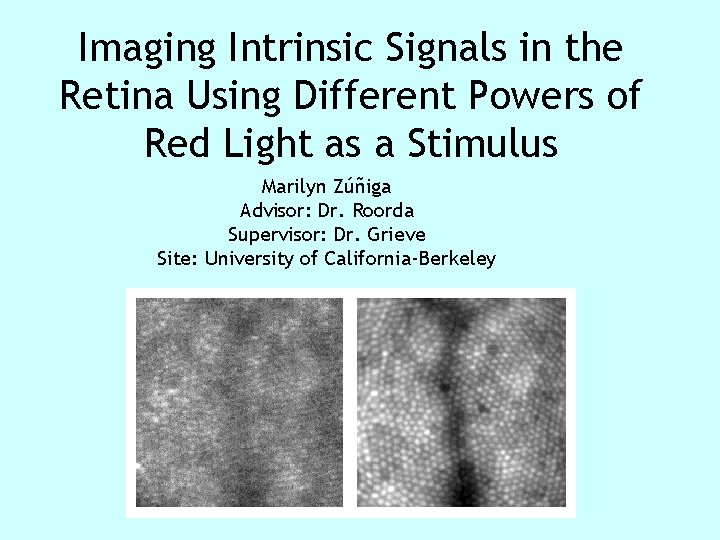 Imaging Intrinsic Signals in the Retina Using Different Powers of Red Light as a Imaging Intrinsic Signals in the Retina Using Different Powers of Red Light as a