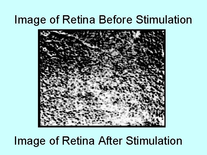 Image of Retina Before Stimulation Image of Retina After Stimulation Image of Retina Before Stimulation Image of Retina After Stimulation