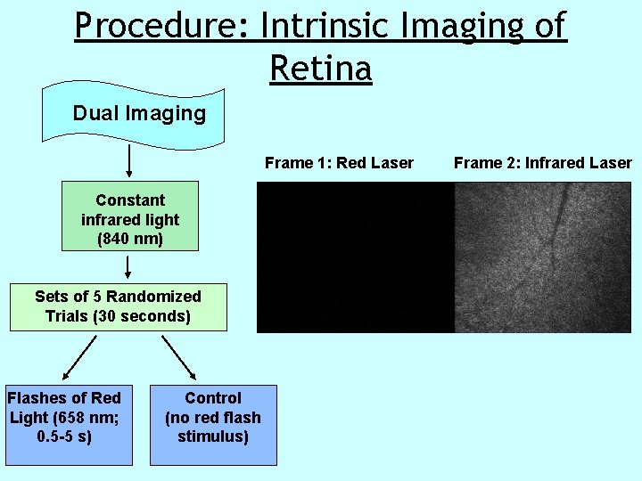 Procedure: Intrinsic Imaging of Retina Dual Imaging Frame 1: Red Laser Constant infrared light Procedure: Intrinsic Imaging of Retina Dual Imaging Frame 1: Red Laser Constant infrared light