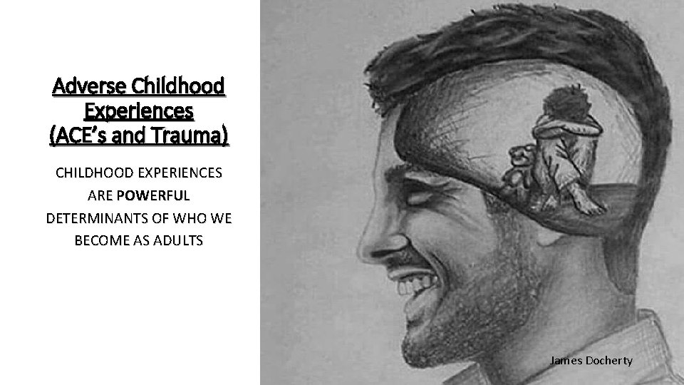 Adverse Childhood Experiences (ACE’s and Trauma) CHILDHOOD EXPERIENCES ARE POWERFUL DETERMINANTS OF WHO WE