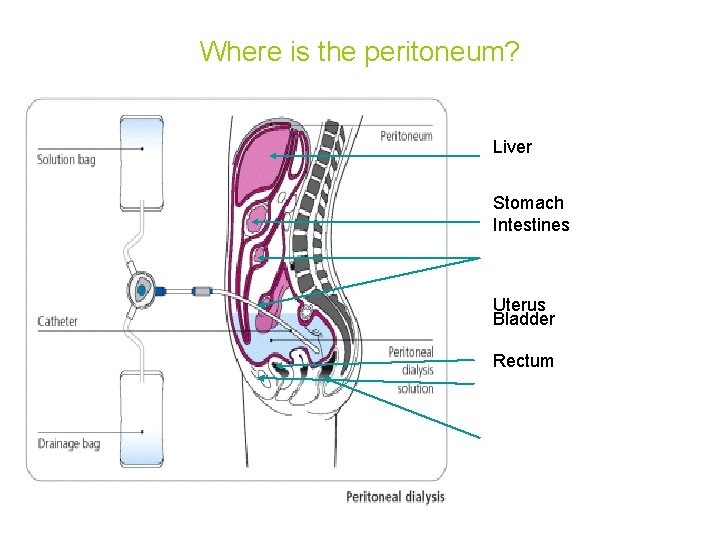 Where is the peritoneum? Liver Stomach Intestines Uterus Bladder Rectum 