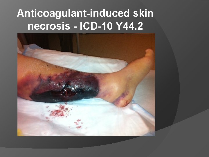 Anticoagulant-induced skin necrosis - ICD-10 Y 44. 2 