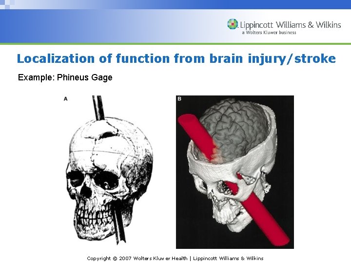 Localization of function from brain injury/stroke Example: Phineus Gage Copyright © 2007 Wolters Kluwer