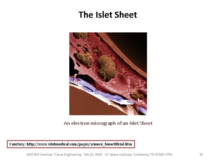 The Islet Sheet An electron micrograph of an Islet Sheet Courtesy: http: //www. isletmedical.