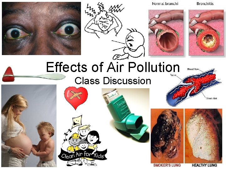 Effects of Air Pollution Class Discussion 