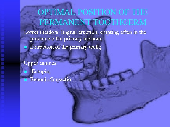 OPTIMAL POSITION OF THE PERMANENT TOOTHGERM Lower incidors: lingual eruption, erupting often in the