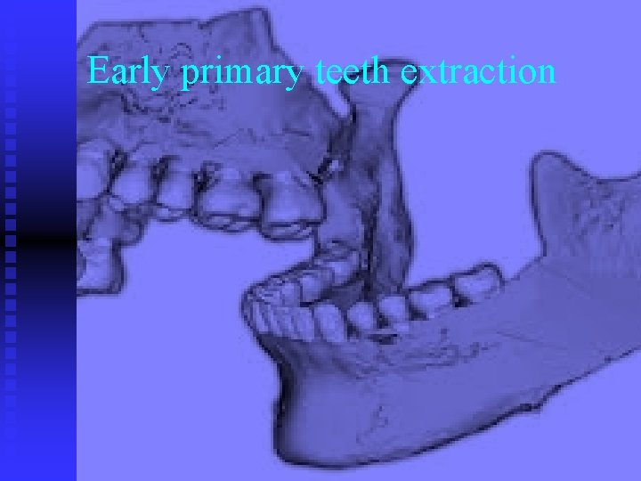 Early primary teeth extraction 