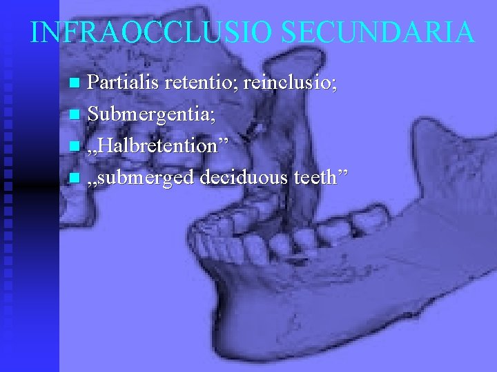 INFRAOCCLUSIO SECUNDARIA Partialis retentio; reinclusio; n Submergentia; n „Halbretention” n „submerged deciduous teeth” n