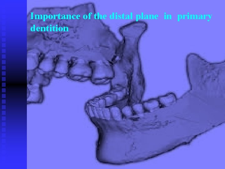 Importance of the distal plane in primary dentition 