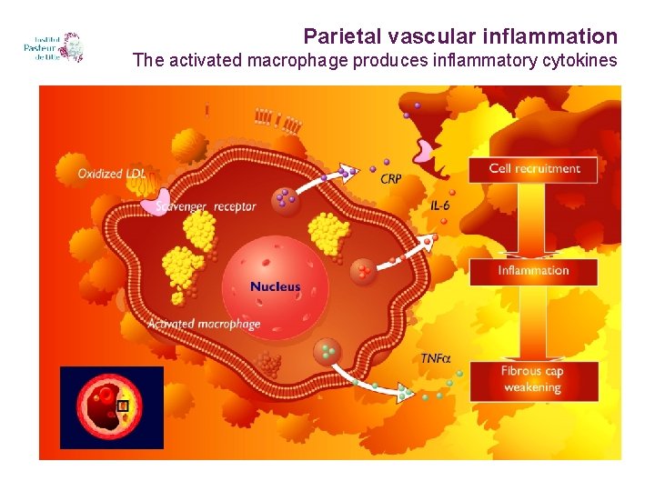 Parietal vascular inflammation The activated macrophage produces inflammatory cytokines 