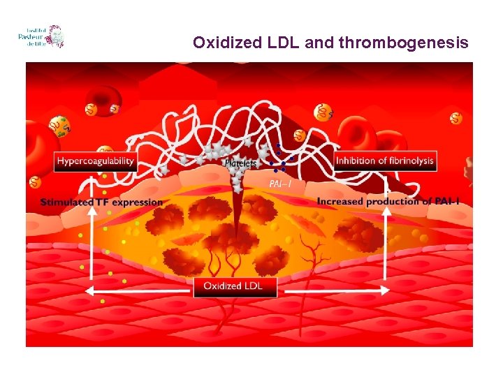 Oxidized LDL and thrombogenesis 