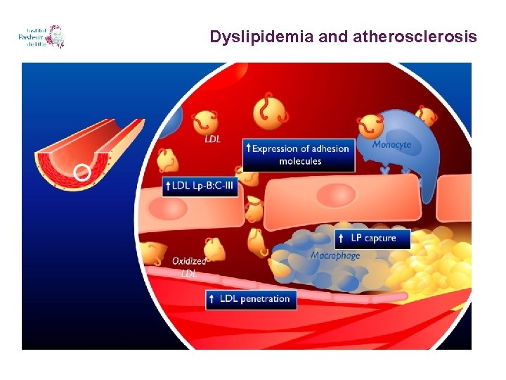 Dyslipidemia and atherosclerosis 