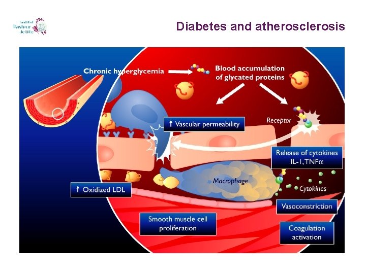 Diabetes and atherosclerosis 