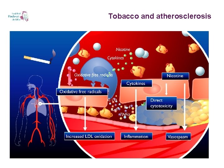 Tobacco and atherosclerosis 