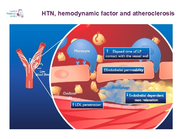 HTN, hemodynamic factor and atheroclerosis 