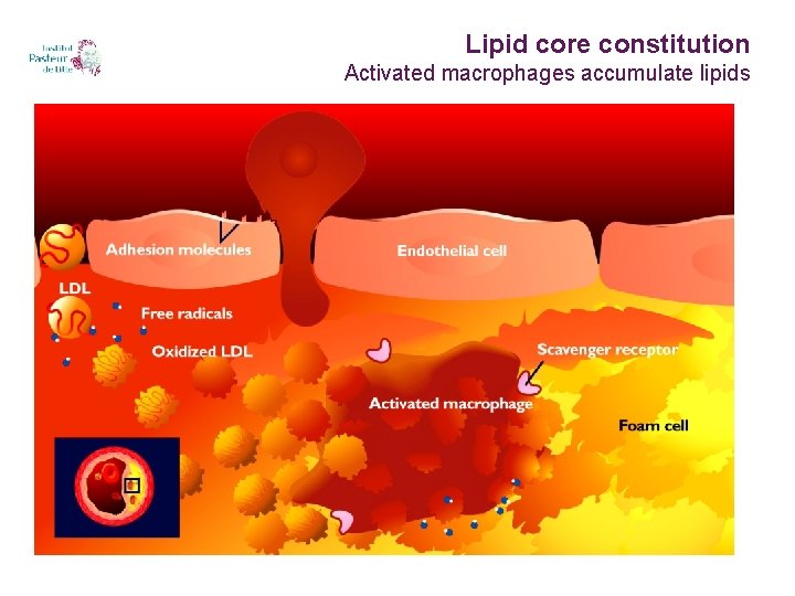 Lipid core constitution Activated macrophages accumulate lipids 