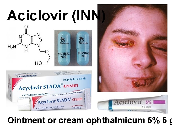 Aciclovir (INN) Ointment or cream ophthalmicum 5% 5 g 