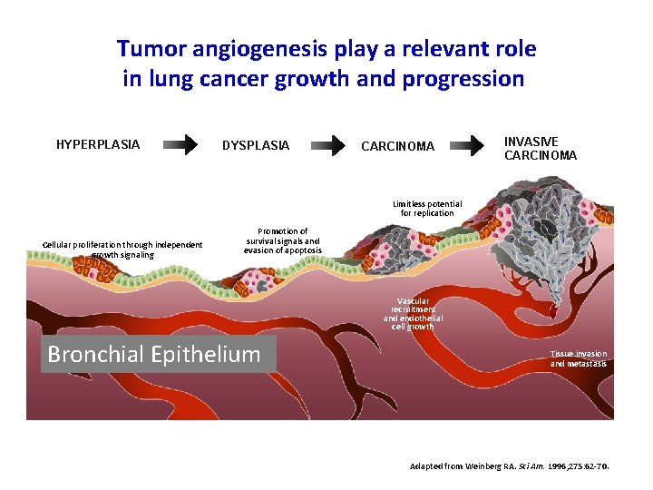 Tumor angiogenesis play a relevant role in lung cancer growth and progression Gene Methylation