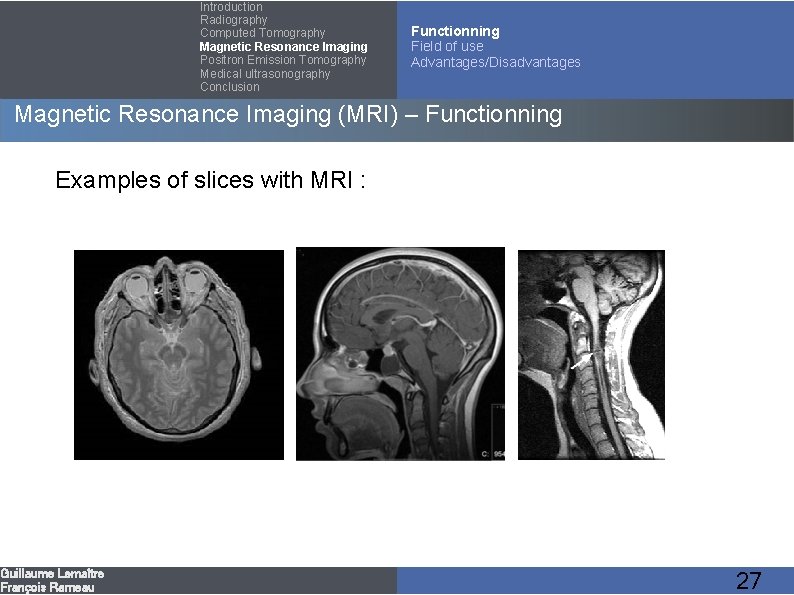 Introduction Radiography Computed Tomography Magnetic Resonance Imaging Positron Emission Tomography Medical ultrasonography Conclusion Functionning