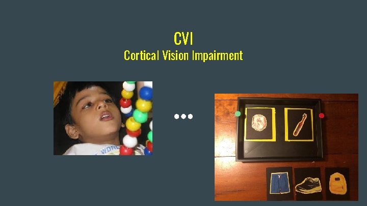 CVI Cortical Vision Impairment 