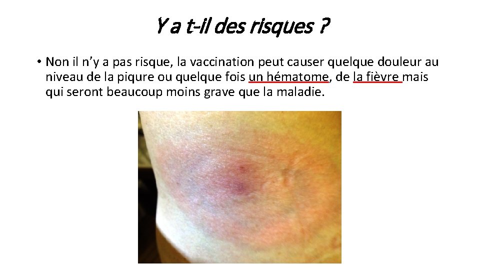 Y a t-il des risques ? • Non il n’y a pas risque, la