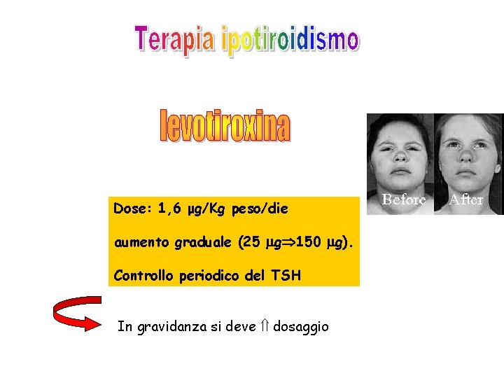 Dose: 1, 6 μg/Kg peso/die aumento graduale (25 g 150 g). Controllo periodico del