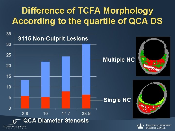 Difference of TCFA Morphology According to the quartile of QCA DS 3115 Non-Culprit Lesions