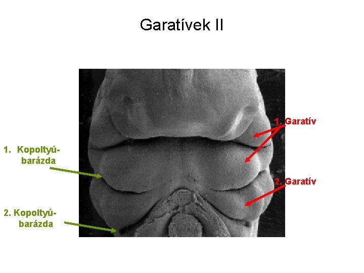 Garatívek II 1. Garatív 1. Kopoltyúbarázda 2. Garatív 2. Kopoltyúbarázda 