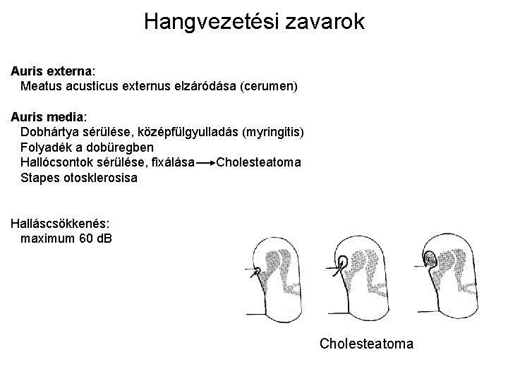 Hangvezetési zavarok Auris externa: Meatus acusticus externus elzáródása (cerumen) Auris media: Dobhártya sérülése, középfülgyulladás