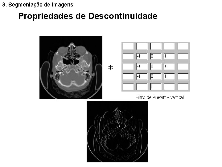 3. Segmentação de Imagens Propriedades de Descontinuidade Filtro de Prewitt - vertical 