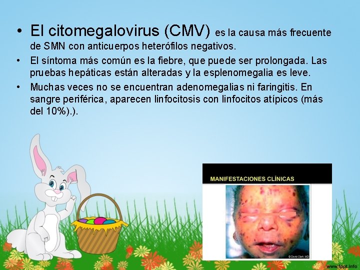  • El citomegalovirus (CMV) es la causa más frecuente de SMN con anticuerpos