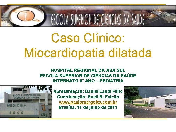 Caso Clínico: Miocardiopatia dilatada HOSPITAL REGIONAL DA ASA SUL ESCOLA SUPERIOR DE CIÊNCIAS DA