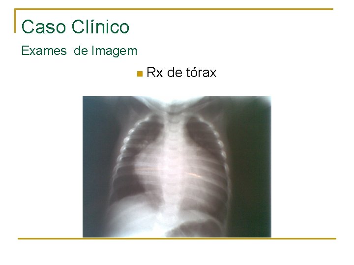 Caso Clínico Exames de Imagem n Rx de tórax 