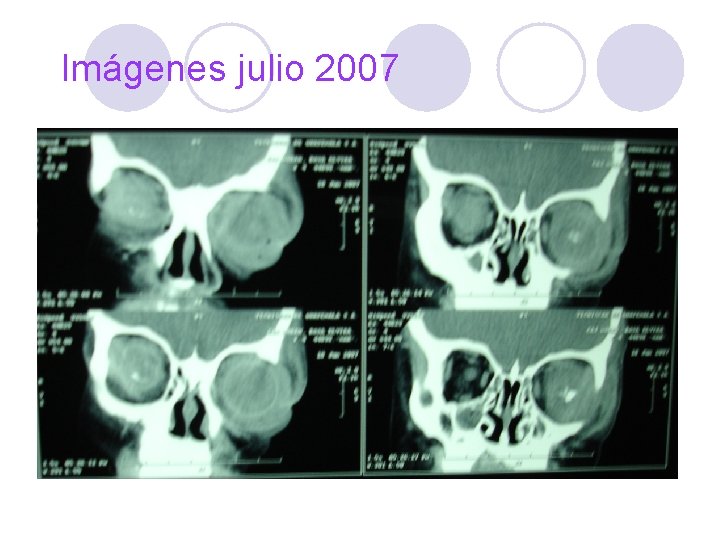 Imágenes julio 2007 