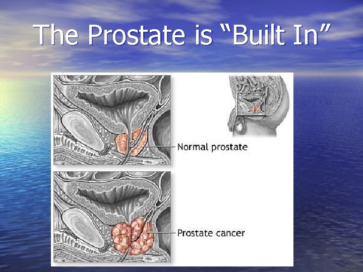 The Prostate is “Built In” 