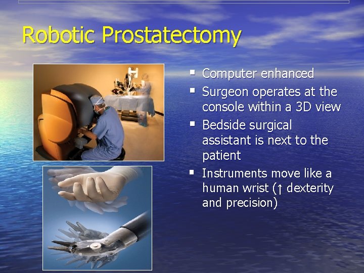 Robotic Prostatectomy § Computer enhanced § Surgeon operates at the console within a 3