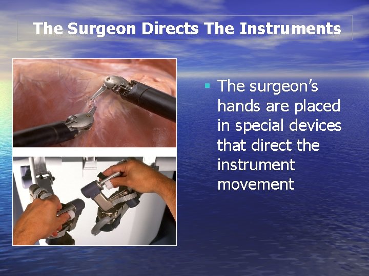 The Surgeon Directs The Instruments § The surgeon’s hands are placed in special devices